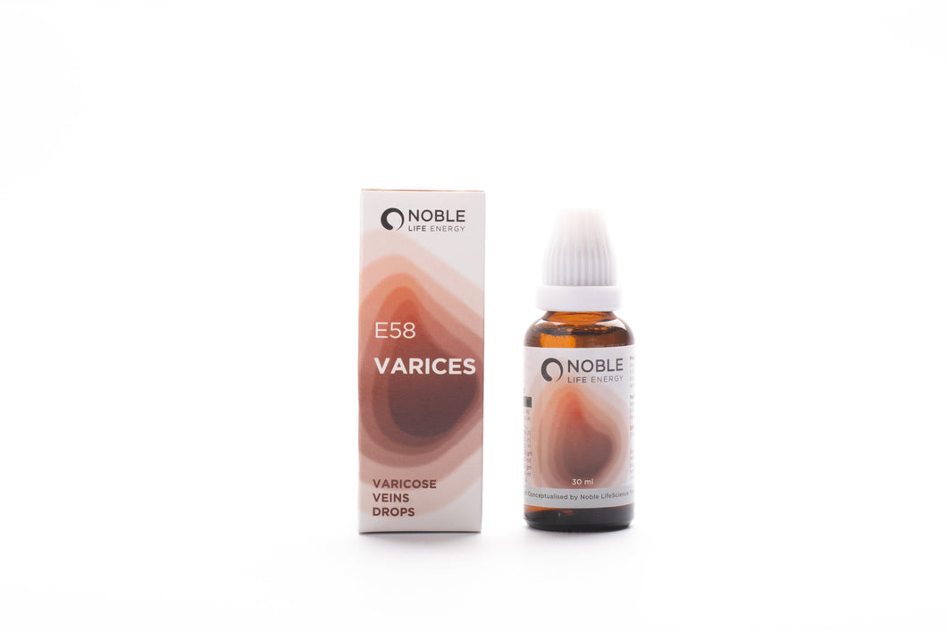Varices